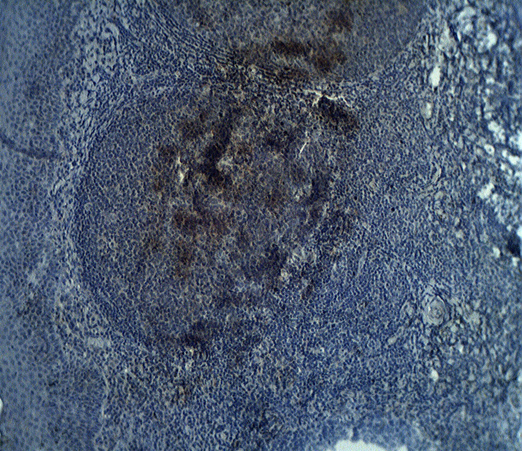 Staining on paraffin embedded normal human tonsil sections. Primary Ab (IgG cut or immunoaffinity purified) at 10 µg/ml. Antigen retrieval used: 10 mM Na Citrate pH 6.0, 10 minutes pressure cooker method., developed with anti rabbit HRP and DAP substrate. Counterstained with methyl blue.